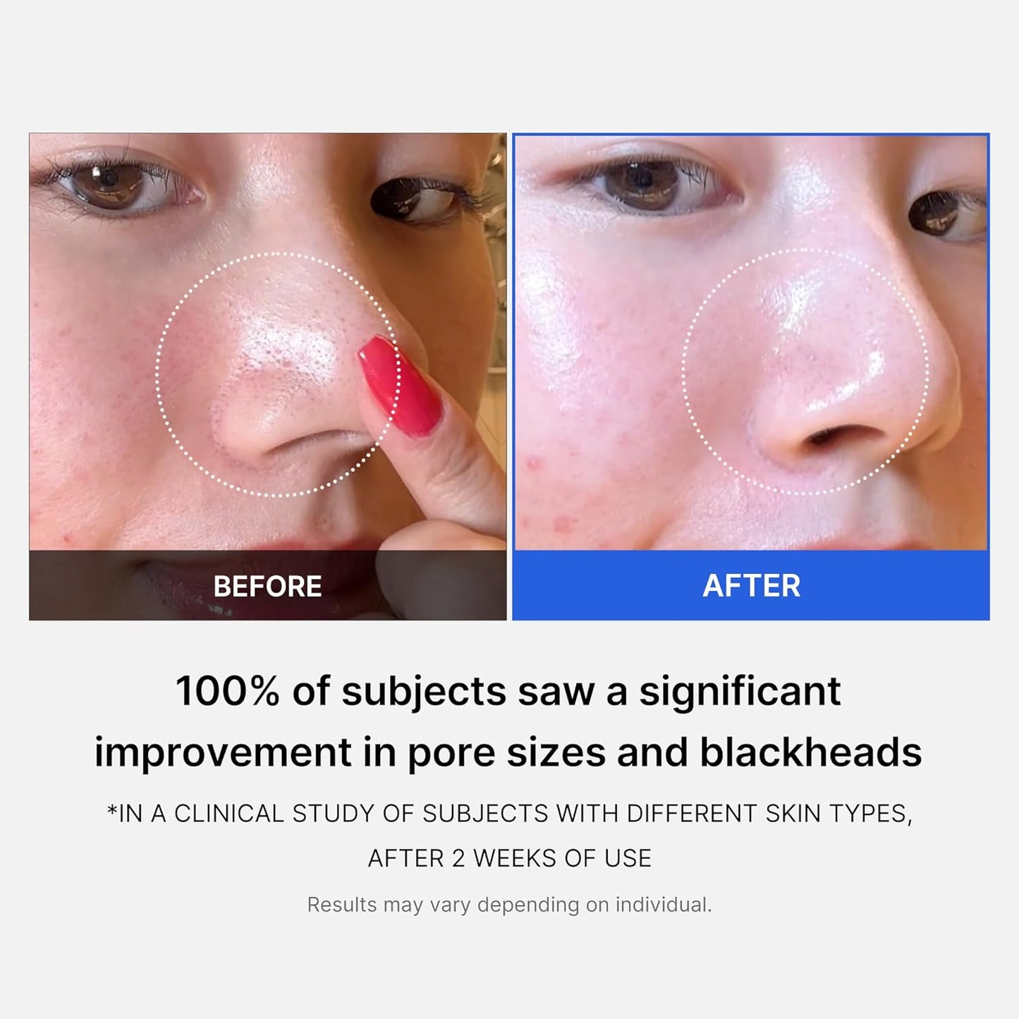 MEDICUBE - Zero Pore Pad 2.0 - 70pcs - Dolly Jolly